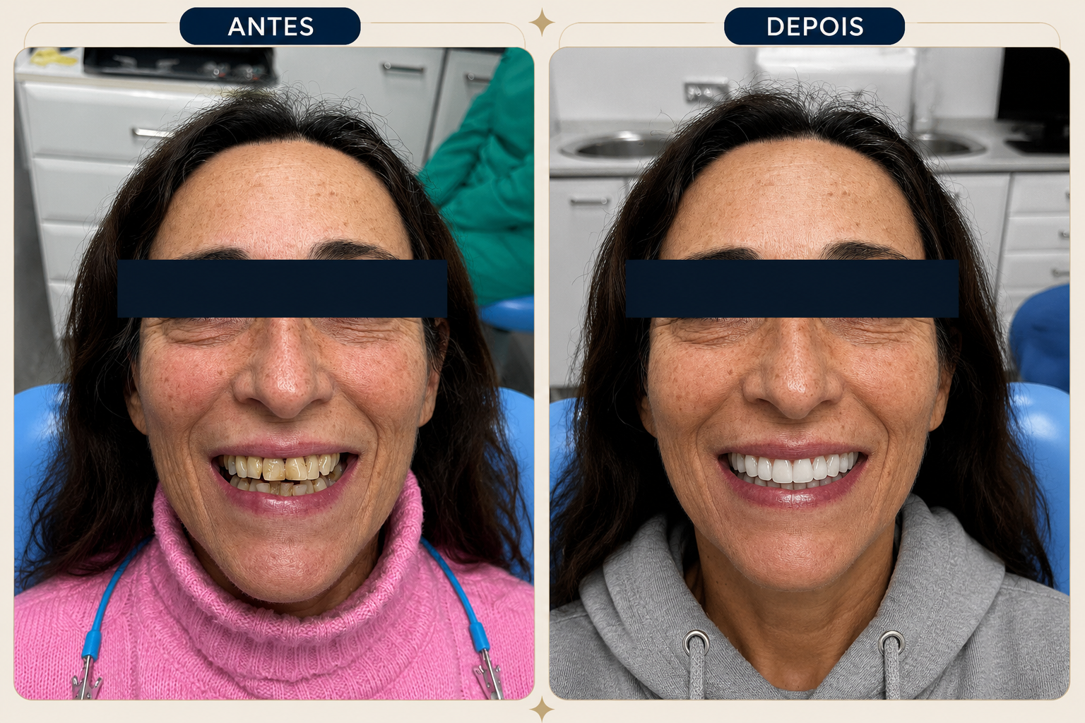 Antes e depois de caso clínico real