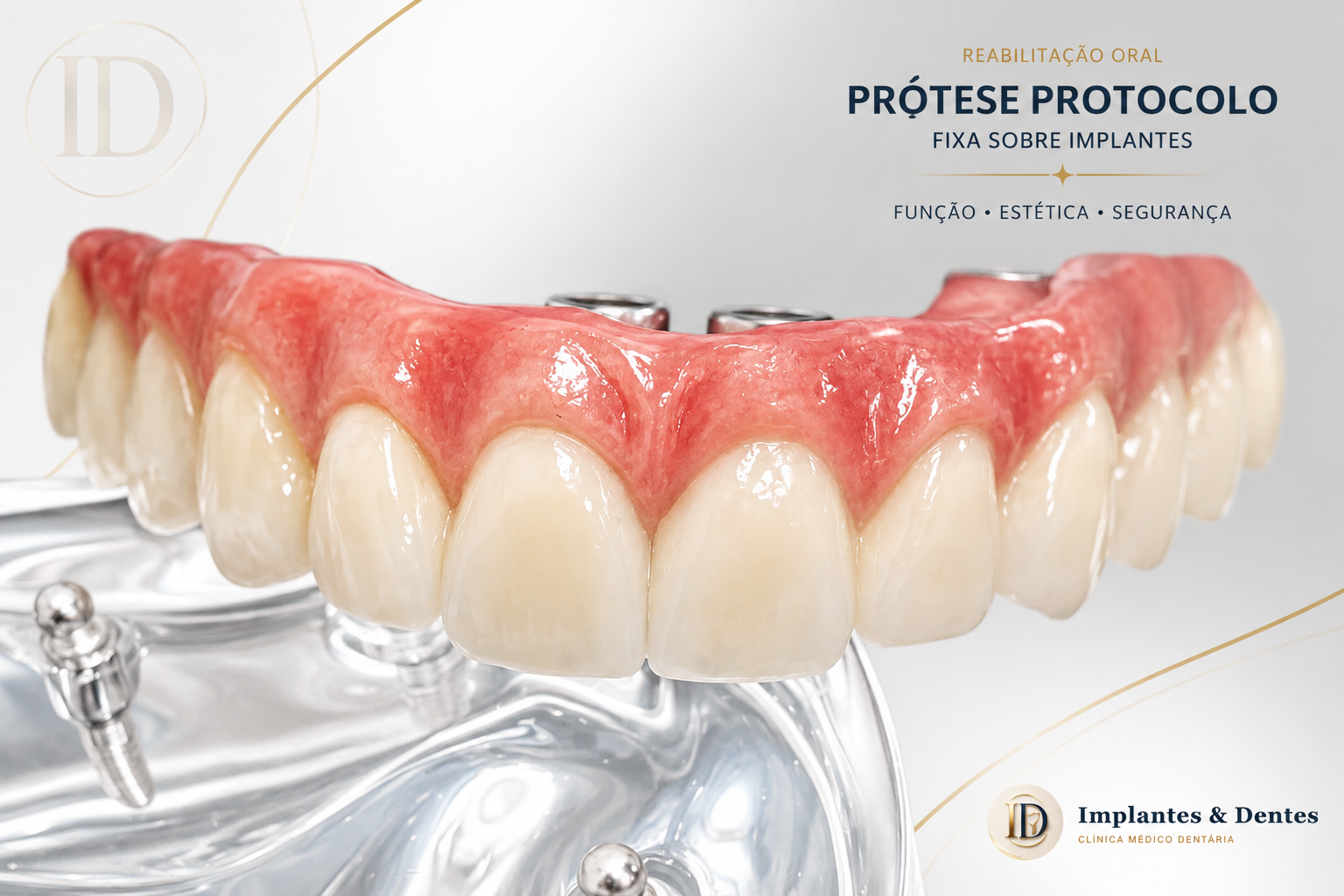 Implantes dentários: uma base para voltar a sorrir e mastigar.